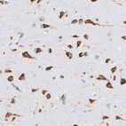Immunohistochemical staining of human cerebral cortex shows strong cytoplasmic positivity in neurons.
