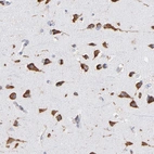 Immunohistochemical staining of human cerebral cortex shows strong cytoplasmic positivity in neurons.