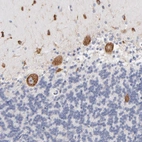 Immunohistochemical staining of human cerebellum shows moderate cytoplasmic positivity in Purkinje cells and in cells in molecular layer.