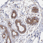 Anti-RPL9 Antibody