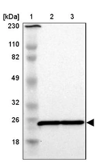 Lane 1: Marker [kDa] 230, 110, 82, 49, 32, 26, 18_br/_Lane 2: Human cell line RT-4_br/_Lane 3: Human cell line U-251MG sp