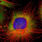 Immunofluorescent staining of human cell line U-251 MG shows localization to nucleoli, cytosol & endoplasmic reticulum.