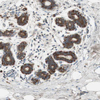 Anti-RPL23 Antibody