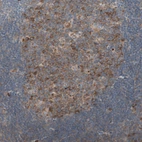 Immunohistochemical staining of human lymph node shows moderate cytoplasmic positivity in germinal center cells.