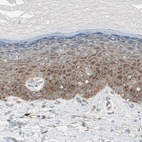 Immunohistochemical staining of human skin shows weak to moderate cytoplasmic positivity in squamous epithelial cells.