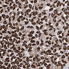 Anti-XKR3 Antibody