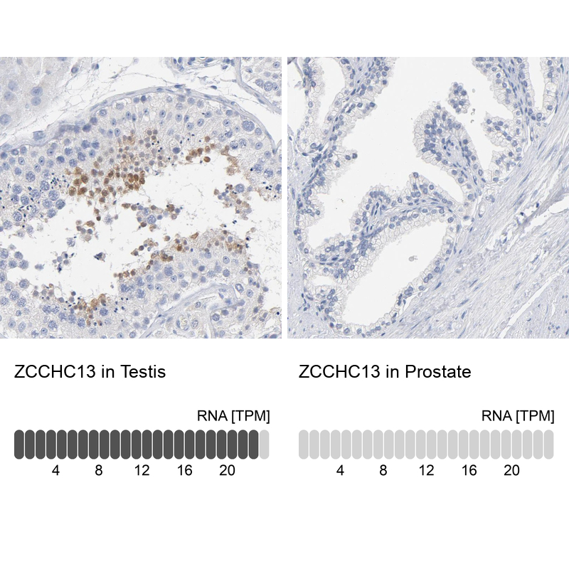 Anti-ZCCHC13 Antibody