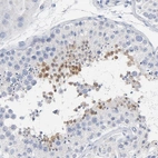 Immunohistochemical staining of human testis shows high expression.