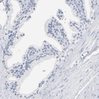 Anti-ZCCHC13 Antibody
