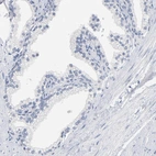 Immunohistochemical staining of human prostate shows low expression as expected.