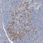 Immunohistochemical staining of human tonsil shows moderate cytoplasmic positivity in germinal center cells.