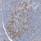 Immunohistochemical staining of human tonsil shows moderate cytoplasmic positivity in germinal center cells.