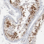 Immunohistochemical staining of human testis shows moderate nuclear positivity in cells in seminiferous ducts.