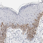 Immunohistochemical staining of human skin shows moderate cytoplasmic positivity in epidermal cells.