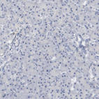 Immunohistochemical staining of human pancreas shows no cytoplasmic positivity in exocrine glandular cells as expected.