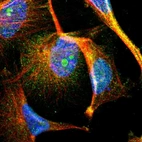 Immunofluorescent staining of human cell line U-251 MG shows localization to nucleus, nucleoli & cytosol.