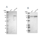 Anti-STRN3 Antibody