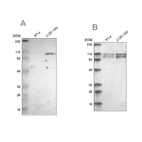 Western blot analysis using Anti-STRN3 antibody HPA003392 (A) shows similar pattern to independent antibody HPA004636 (B).