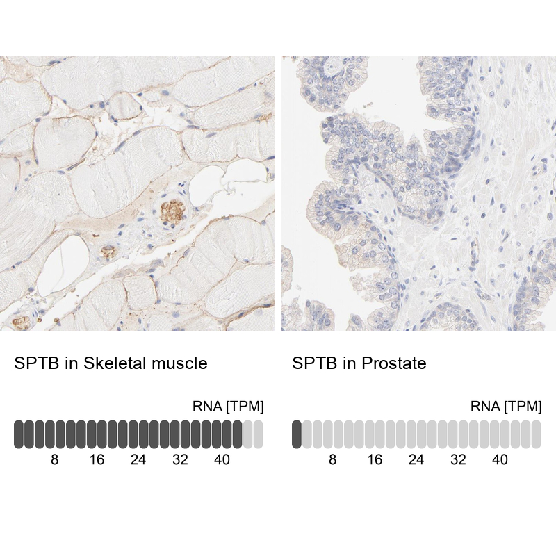 Anti-SPTB Antibody