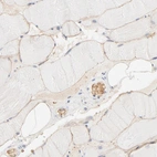 Immunohistochemical staining of human skeletal muscle shows high expression.
