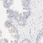 Anti-SPTB Antibody