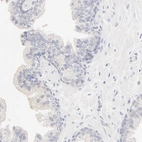 Immunohistochemical staining of human prostate shows low expression as expected.