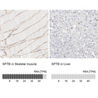 Anti-SPTB Antibody