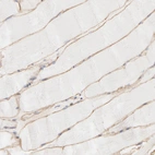 Immunohistochemical staining of human skeletal muscle shows moderate membranous positivity in myocytes.