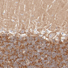 Immunohistochemical staining of human cerebellum shows moderate membranous positivity in Purkinje cells.