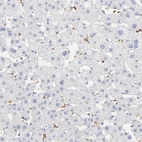 Immunohistochemical staining of human liver shows no expression in hepatocytes as expected.