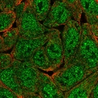 Immunofluorescent staining of human cell line RT4 shows localization to nucleoplasm, cytosol & aggresome.