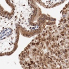 Anti-RPL12 Antibody