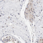 Immunohistochemical staining of human testis shows weak to moderate positivity in mitochondria in Leydig cells.