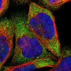Immunofluorescent staining of human cell line A-431 shows localization to cytosol.