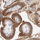 Immunohistochemical staining of human Placenta shows strong extracellular space positivity in trophoblastic cells.