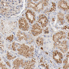 Immunohistochemical staining of human kidney shows moderate to strong extracellular space positivity in cells in tubules.