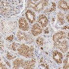 Immunohistochemical staining of human kidney shows moderate to strong extracellular space positivity in cells in tubules.