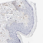 Immunohistochemical staining of human Skin shows no cytoplasmic positivity in epidermal cells as expected.