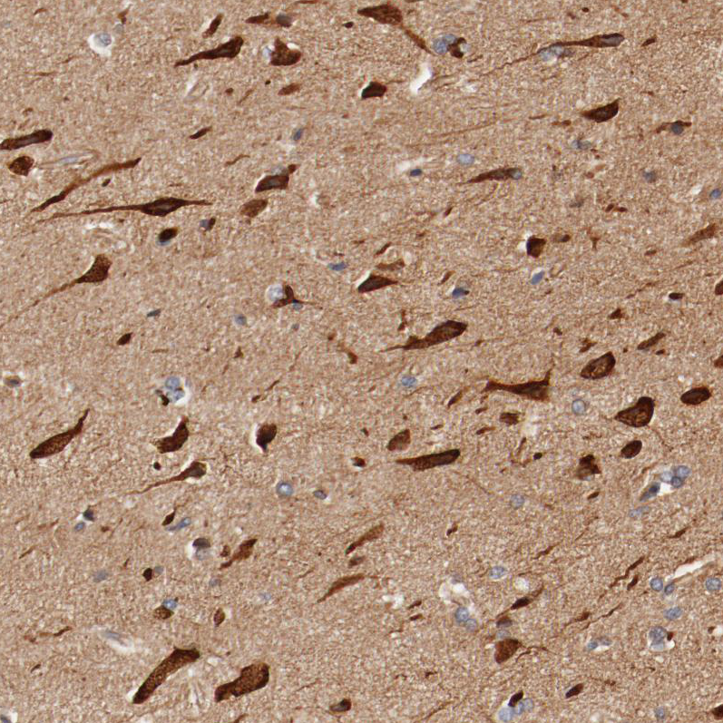 Anti-PITPNM2 Antibody
