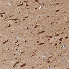 Anti-PITPNM2 Antibody