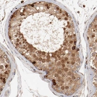 Immunohistochemical staining of human testis shows strong cytoplasmic and membranous positivity in cells in seminiferous ducts.