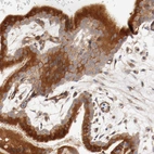 Immunohistochemical staining of human placenta shows strong cytoplasmic and membranous positivity in trophoblastic cells.