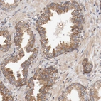 Immunohistochemical staining of human prostate shows moderate cytoplasmic and membranous positivity in glandular cells.