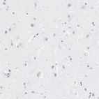 Immunohistochemical staining of human cerebral cortex shows no positivity in neurons as expected.
