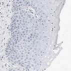 Immunohistochemical staining of human skin shows no positivity in squamous epithelial cells as expected.