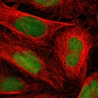 Immunofluorescent staining of human cell line U-2 OS shows localization to nucleus.