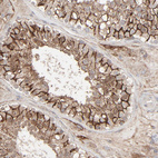 Anti-JAM3 Antibody