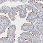 Immunohistochemical staining of human Fallopian tube shows strong positivity in cilia in glandular cells.