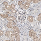 Immunohistochemical staining of human kidney shows moderate cytoplasmic positivity in cells in tubules.