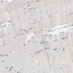 Immunohistochemical staining of human skeletal muscle shows no cytoplasmic positivity in myocytes as expected.